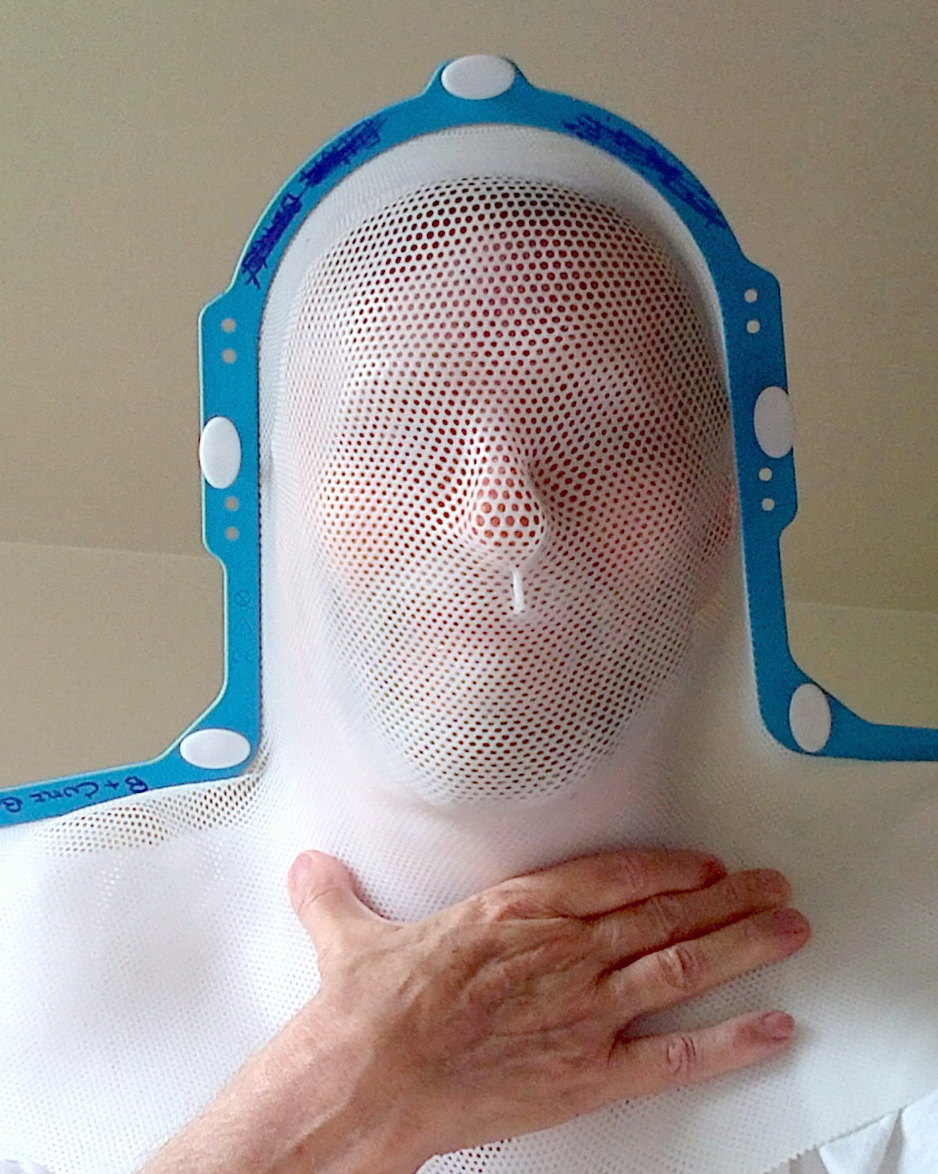 radiation mask --- bolted my head to table for radiation to neck